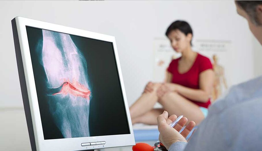 Consultazione con un medico se si sospetta l'artrite o l'artrosi