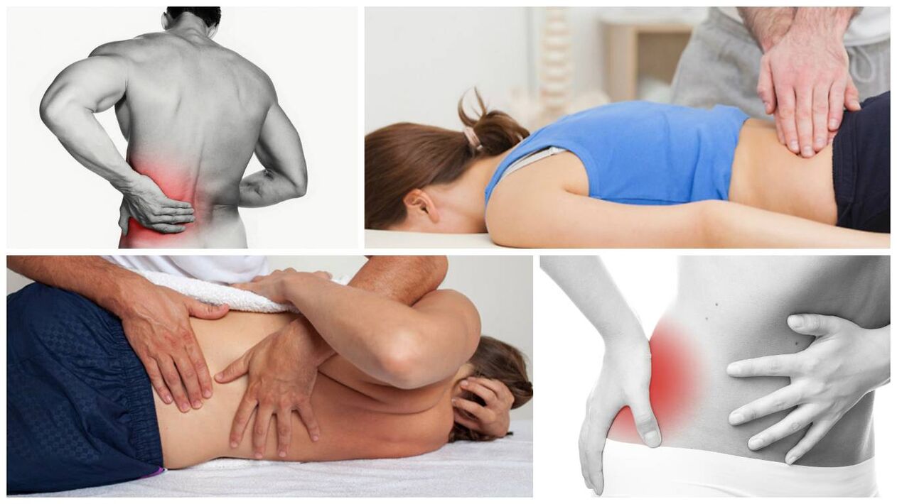sintomi e cause del mal di schiena