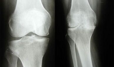 Metodi di diagnosi del ginocchio
