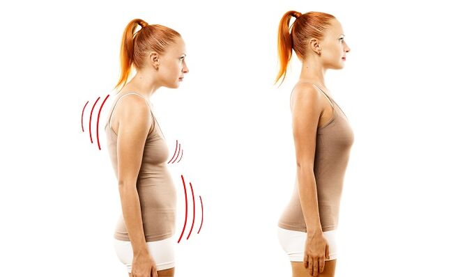 chinarsi come causa dello sviluppo dell'osteocondosi lombare