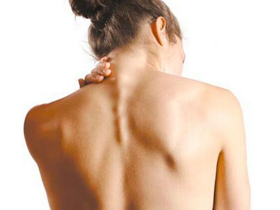 La ragazza ha l'osteocondrosi cervicale