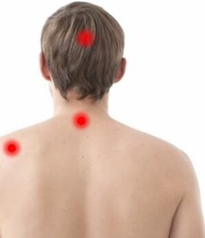 luogo del dolore nell'osteocondrosi cervicale