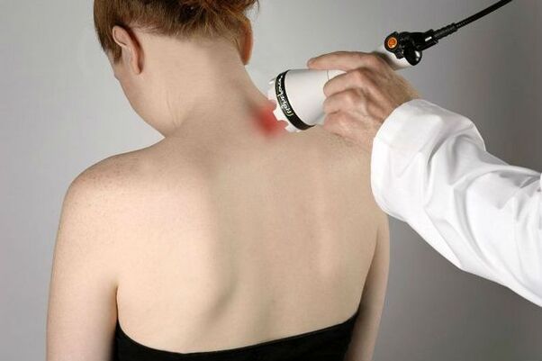 misure fisioterapeutiche per il trattamento dell'osteocondrosi cervicale